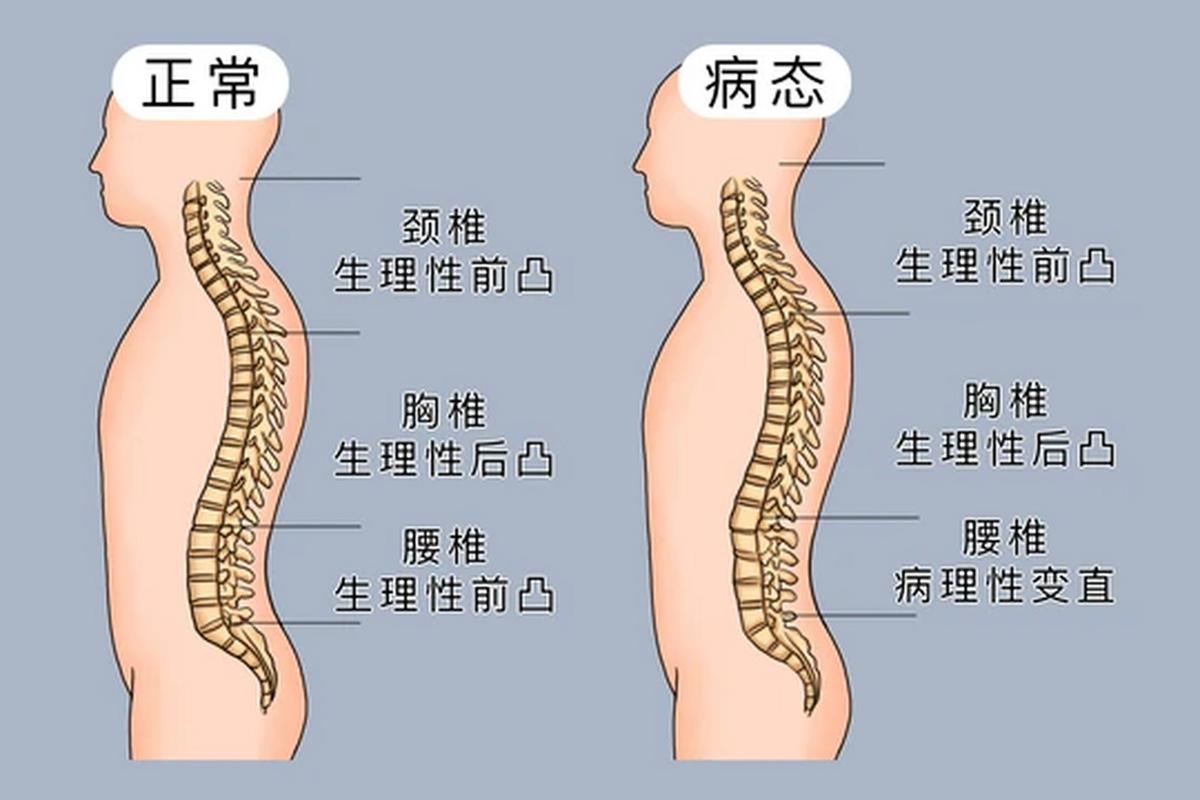 喝酒对盆底肌的影响:路径三:应酬时的腹压
