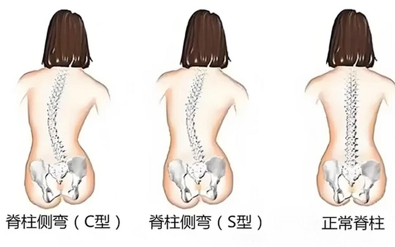 擤鼻涕腹压:鼻后滴漏和长期咳嗽更值得注意