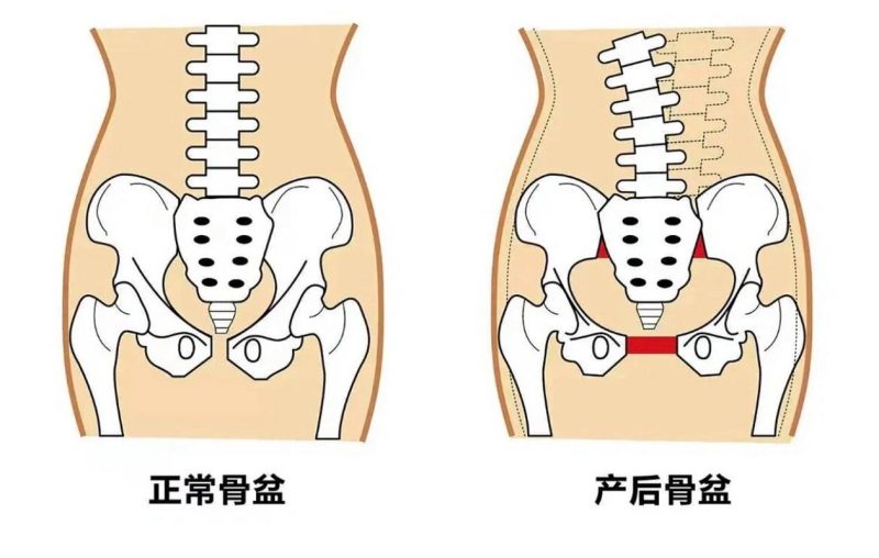 有慢性咳嗽的人练盆底肌,要调整哪 3 件事-男性盆底肌训练社区_凯格尔运动与PC肌怎么练 - P动