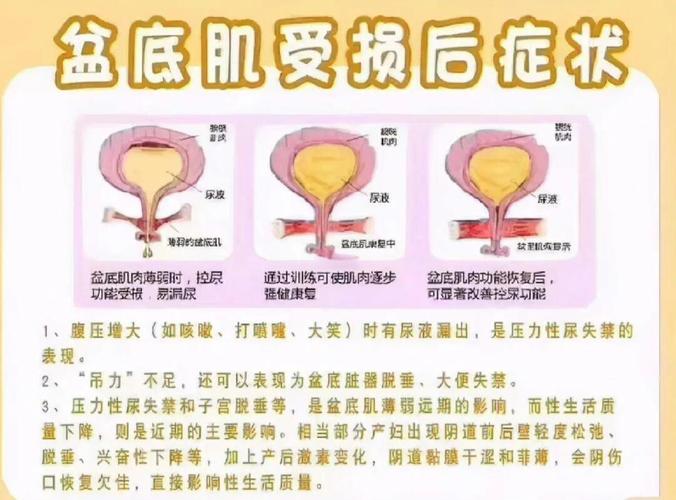影响盆底肌的日常习惯:三个里先改哪个