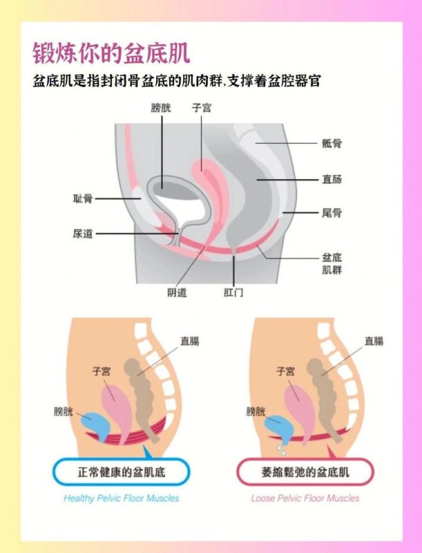 一次收缩要保持几秒？3 个阶段的时长参考-男性盆底肌训练社区_凯格尔运动与PC肌怎么练 - P动