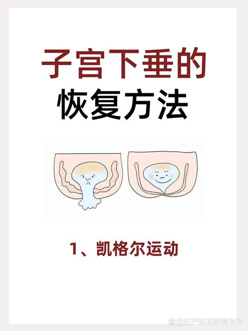 凯格尔收缩力度：满档什么时候用