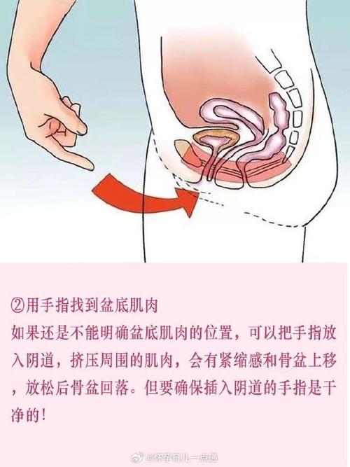 练凯格尔腰拱:腰拱是个信号,不是姿势问题