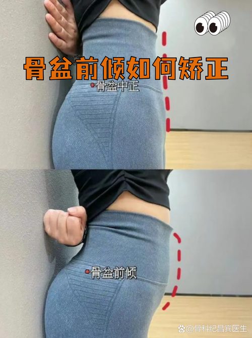 体重偏重的人练盆底肌，动作上要注意什么-男性盆底肌训练社区_凯格尔运动与PC肌怎么练 - P动