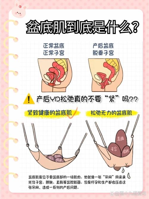 跑步人群盆底肌:跑量大的人要额外注意两件事