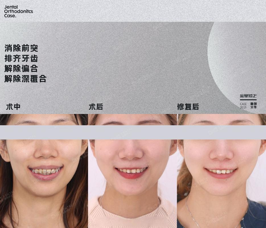 慢收缩进阶：快收缩怎么加