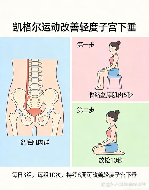 盆底肌训练影响因素:三个因素叠加时怎么排