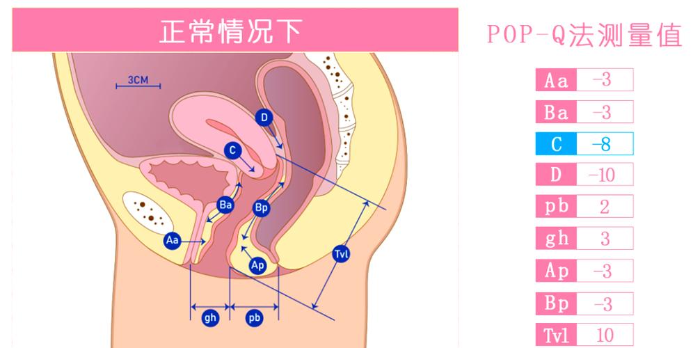 盆底评估科室:去之前准备什么